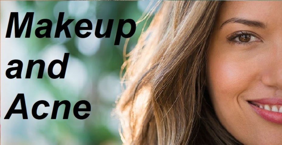 Makeup and Acne
