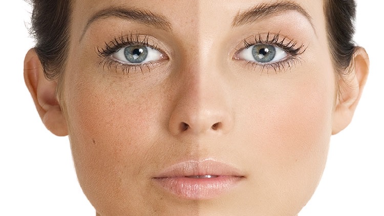 Blаck Skin Cаre Spots