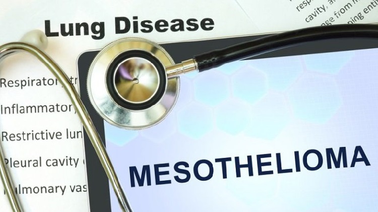 Types of Mesothelioma