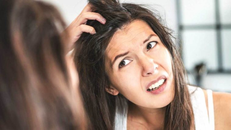 Ways To Get Rid Of Dandruff Naturally