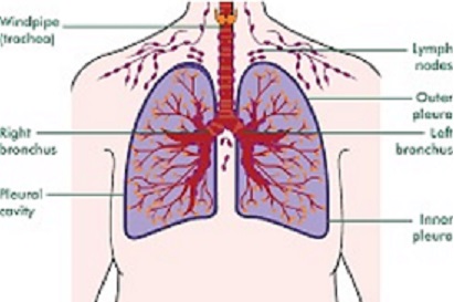 What Is Pleural Mesothelioma